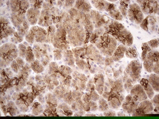 KRT18 / CK18 / Cytokeratin 18 Antibody (aa69-372, clone OTI2H10)