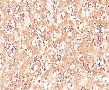 Alpha-Fetoprotein Antibody (clone C3, Azide-free, BSA-free)