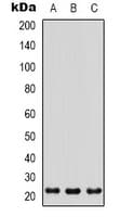 Polyclonal Rabbit anti-Human PGLYRP1 / PGRP Antibody (Internal, WB)