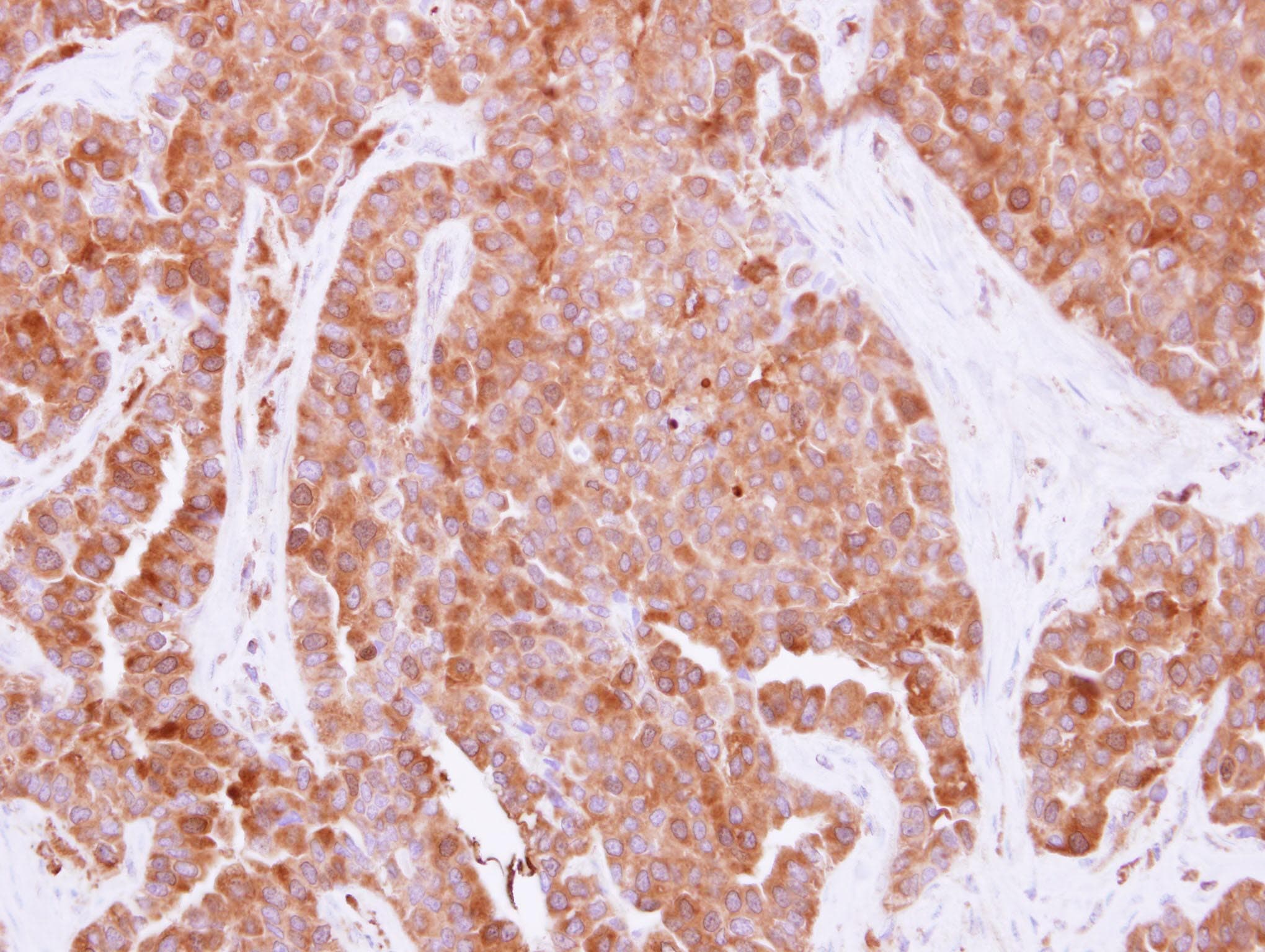 HPRT1 / HPRT Antibody (aa1-218)