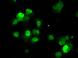 PME-1 / PPME1 Antibody (clone OTI2C5)