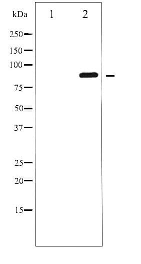 GRIA2 / GLUR2 Antibody (phospho-Ser880)