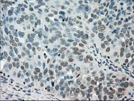 STK39 / SPAK Antibody (clone OTI3C12)