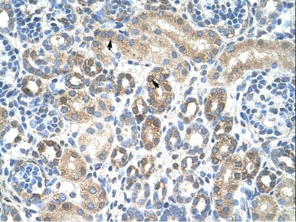 Polyclonal Rabbit anti-Human CAV1 / Caveolin 1 Antibody (N-Terminus, IHC, WB)