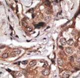 HTRA1 Antibody (aa381-412)