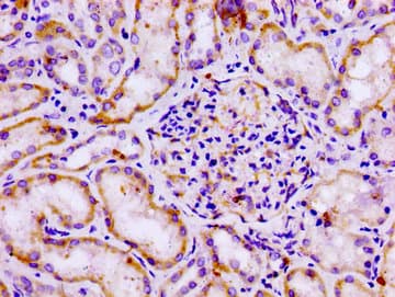 Polyclonal Rabbit anti-Human GPR12 Antibody (IHC, WB)