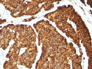 CHGA / Chromogranin A Antibody (clone CHGA/777, Ready-to-Use)