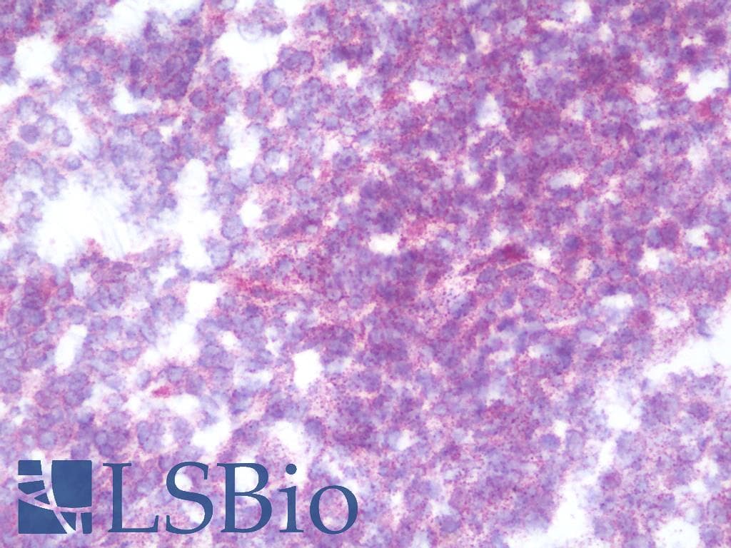 IHC-plus™ Polyclonal Rabbit anti-Human HCCS Antibody (aa81-130, IHC, IF, WB)