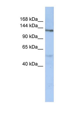 Polyclonal Rabbit anti-Human CHSY3 / CSS3 Antibody (aa107-156, WB)