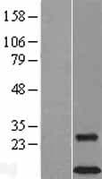 DAP12 Protein (Over-Expression Lysate Myc-DDK (Flag))