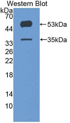 ANGPTL4 Antibody (aa182-388)