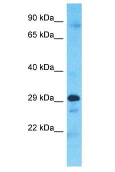 Polyclonal Rabbit anti-Human CCDC28A Antibody (aa204-253, WB)