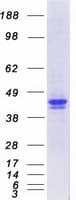 Human SERPINA1 / Alpha 1 Antitrypsin Protein (Recombinant Myc-DDK (Flag))