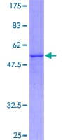 Human SLC25A6 / ANT3 Protein (Recombinant GST)