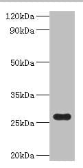 Polyclonal Rabbit anti-Escherichia coli NAD(P)H-flavin reductase Antibody (WB)