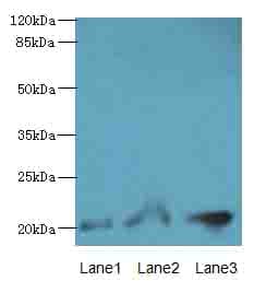 PLLP / Plasmolipin Antibody
