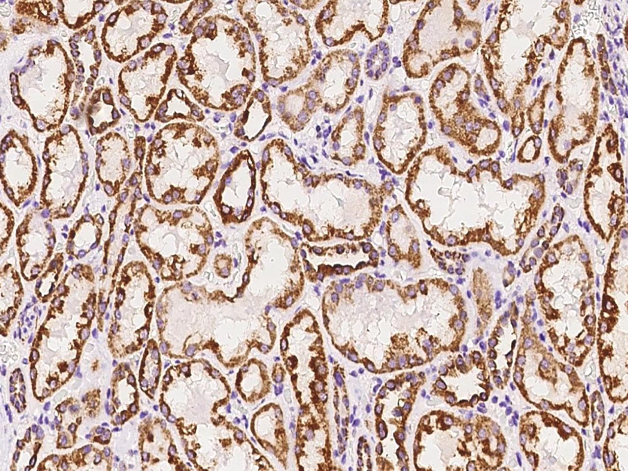 NDUFB7 / B18 Antibody