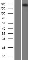 A2ML1 Protein (Over-Expression Lysate Myc-DDK (Flag))