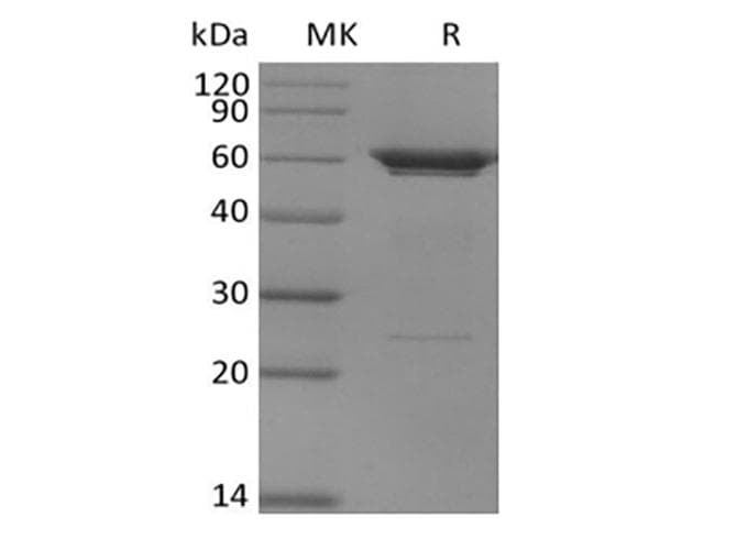 Human PFK2 / PFKFB3 Protein (Recombinant 6His, N-terminus)