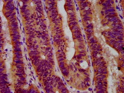 Polyclonal Rabbit anti-Human GBA / Glucosidase Beta Acid Antibody (IHC, WB)