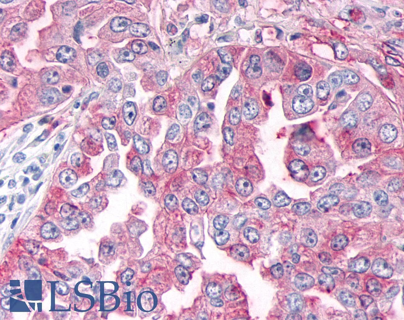PathPlus™ Polyclonal Rabbit anti-Human ADAMTS4 Antibody (Disintegrin-like Domain, IHC)