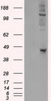 IHC-plus™ LOX / Lysyl Oxidase Antibody (clone 9A11)