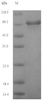 Epstein-Barr Virus EBV (strain B95-8) GP350 Protein (Recombinant 6His-SUMO, N-terminus)