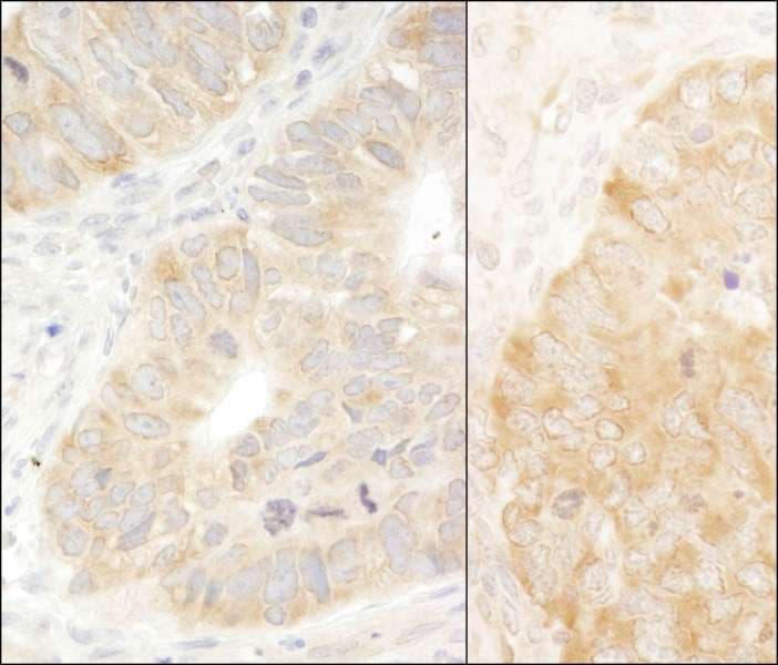 EIF2S1 Antibody (aa275-C-term)