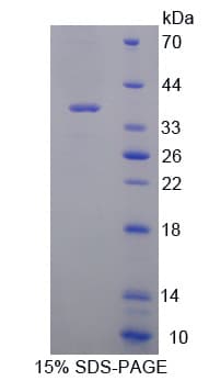 Mouse PCSK1 Protein (Recombinant His-T7)
