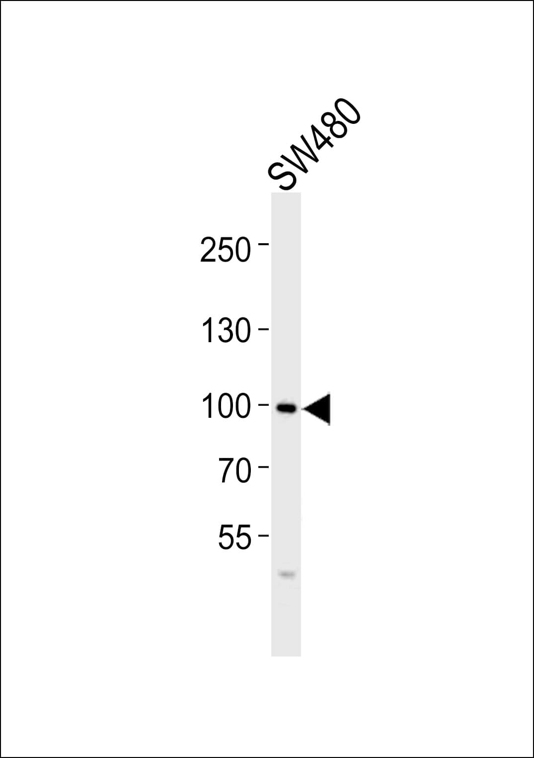 FGFR4 Antibody (aa143-178)