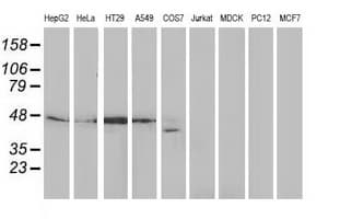DNAJB1 / Hsp40 Antibody (clone OTI1A12)