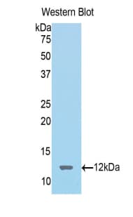 SST / Somatostatin Antibody (aa27-116)