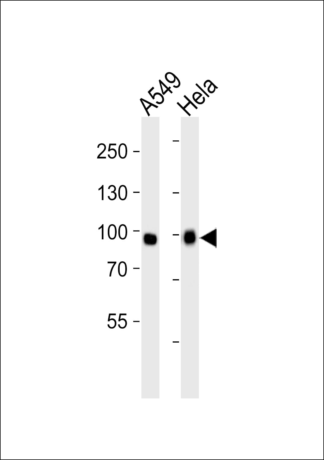 Polyclonal Rabbit anti-Human FGFR3 Antibody (aa449-482, WB)