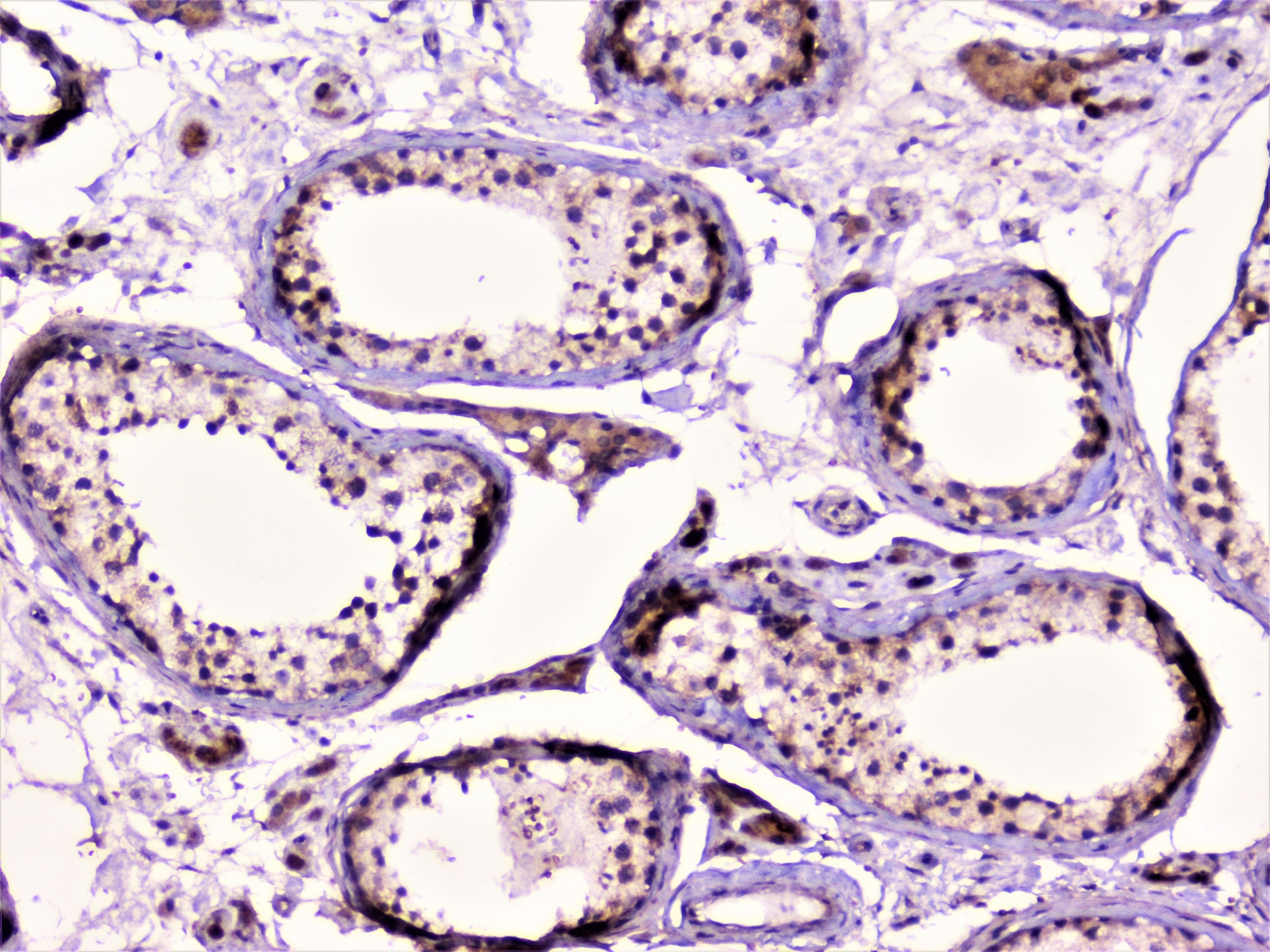 RAD51 / RECA Antibody