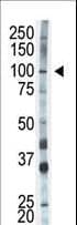 HK1 / Hexokinase 1 Antibody (aa78-108)