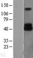 DCT / Dopachrome Tautomerase Protein (Over-Expression Lysate Myc-DDK (Flag))