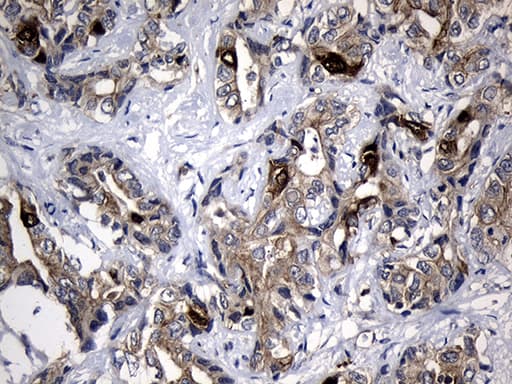 RRM2 Antibody (clone OTI3D3)