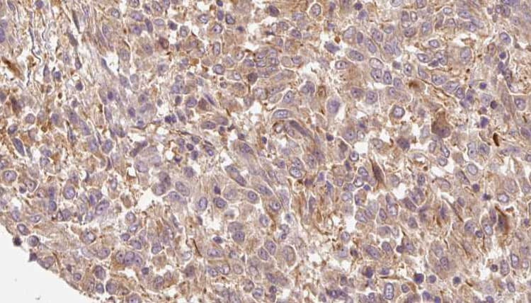 Polyclonal Rabbit anti-Human SFRP-3 / FRZB Antibody (IHC, WB)