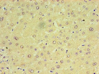 MIA40 / CHCHD4 Antibody (aa1-142)