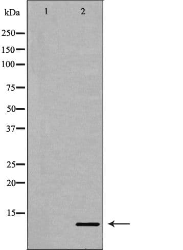 Polyclonal Rabbit anti-Human IL8 / Interleukin 8 Antibody (IHC, WB)
