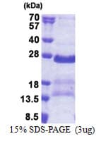 Human GAGE2A Protein (Recombinant His)