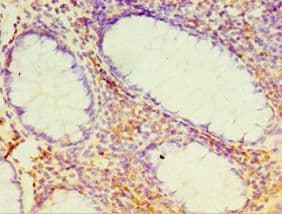 DHX58 / LGP2 Antibody (aa389-678)