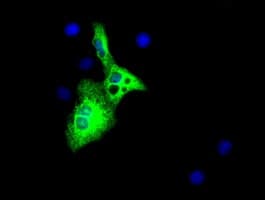 PathPlus™ Alpha-Fetoprotein Antibody (clone OTI2E2)