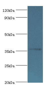 AKR1B10 Antibody (aa1-316)