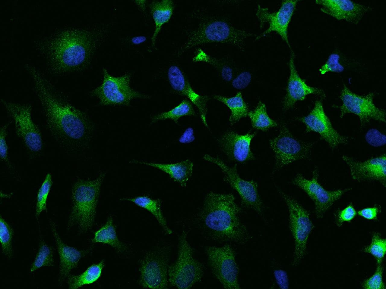 SRP72 Antibody