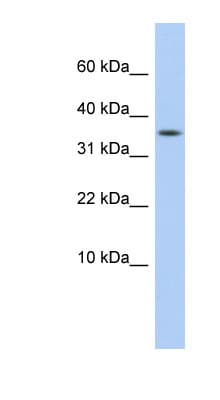 Polyclonal Rabbit anti-Human PPP1R27 / DYSFIP1 Antibody (C-Terminus, WB)