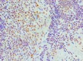 Polyclonal Rabbit anti-Human NONO / P54NRB Antibody (aa1-300, IHC)