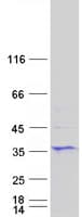 Human STEAP1 / STEAP Protein (Recombinant Myc-DDK (Flag))