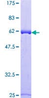 Human ALAD Protein (Recombinant GST)