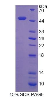 Human Dynactin 2 / Dynamitin Protein (Recombinant His, N-Terminal)